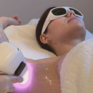 LÁSER-DIODO-tratamientos-Inside Beauty
