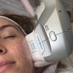 HIFU Ultraformer Cyber Monday