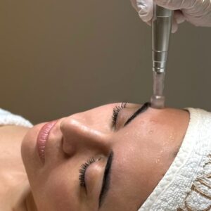 Regala NeopenMed Pro: Peeling + Microneedling + Boost Complex