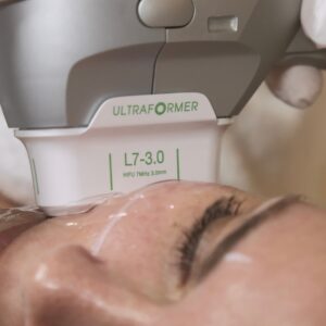 Regala HIFU Ulfit Facial