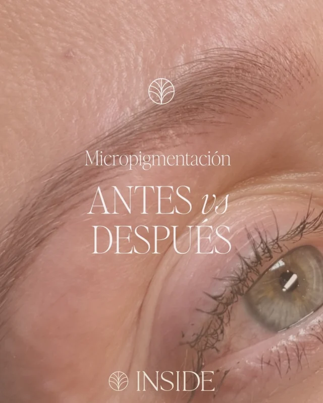 Nuestra clienta llegó con cejas poco definidas y zonas despobladas 🔍 Con la técnica de Nanoblading, simulamos pelitos con precisión para conseguir un diseño natural, armónico y acorde a sus facciones.

¿El resultado? Una mirada más expresiva y cejas perfectas sin necesidad de maquillaje 🤎

Pide tu diagnóstico de cortesía y transforma tu mirada ✨

INSIDE BEAUTY - 𝐸𝑛 𝑎𝑟𝑚𝑜𝑛𝑖𝑎 𝑐𝑜𝑛 𝑡𝑢 𝑏𝑒𝑙𝑙𝑒𝑧𝑎

💬+34 679 11 94 20
📍C/Joan Güell, 236, Barcelona (Alura)